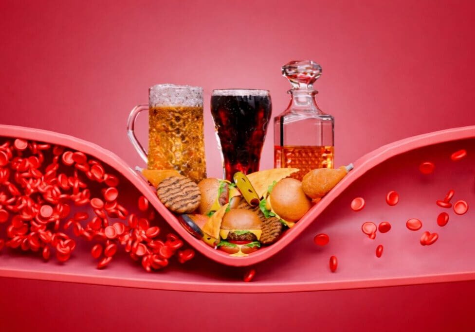 Standard American Diet (SAD)